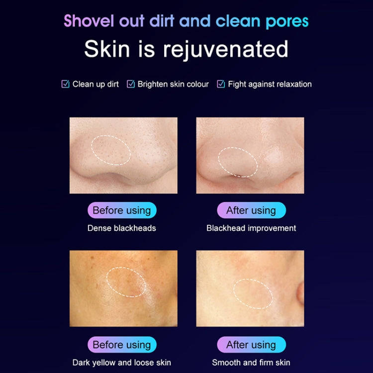 YJK028 3.7V 250mAh Second Generation Ultrasonic Ion Cleansing Instrument