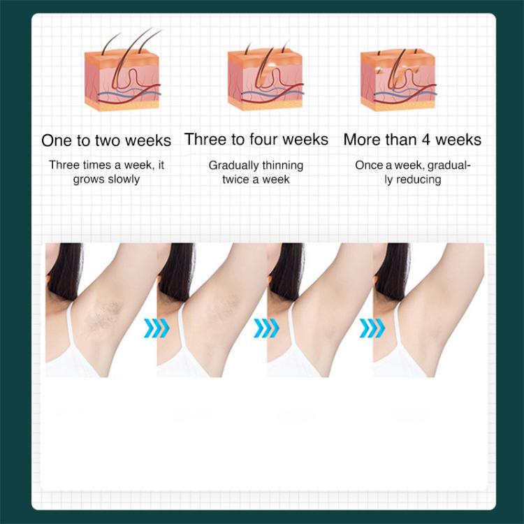 FY-B501 Laser Hair Removal Device Home Electric IPL Intense Pulse Hair Remover