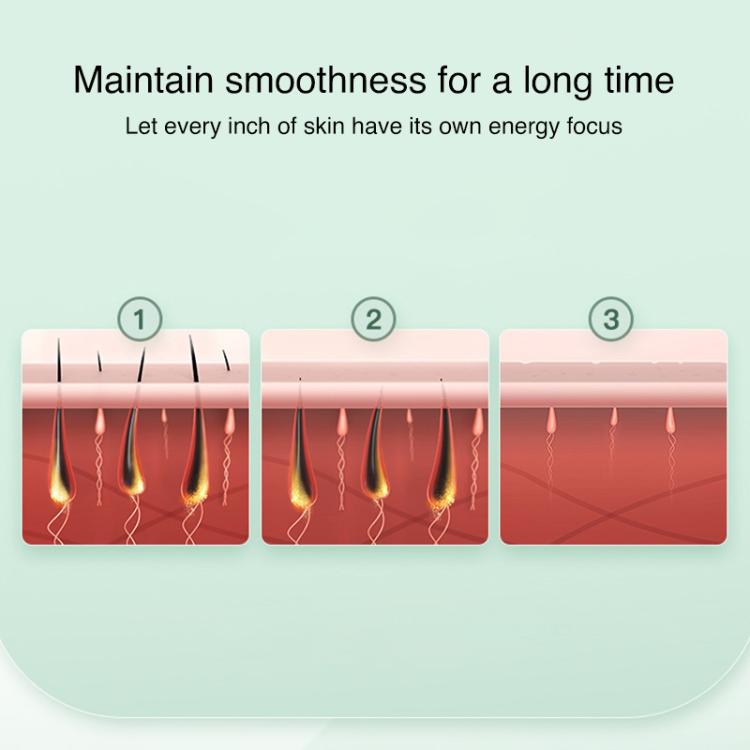 FY-B502 Portable Laser Hair Removal Device Photon Electric IPL Intense Pulse Hair Remover