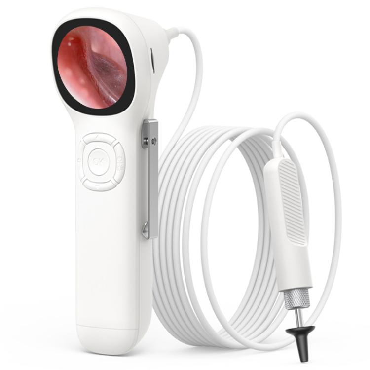 TESLONG SA160 1.45 Inch HD Screen Handheld Smart Visual Otoscope