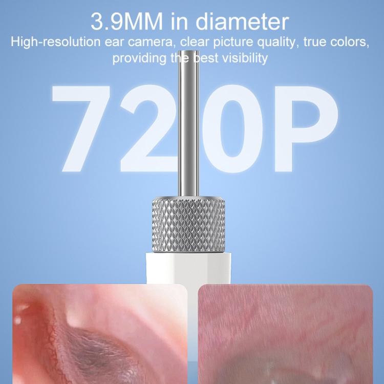 TESLONG SA200 1.85 Inch Screen WIFI Handheld Smart Visual Otoscope