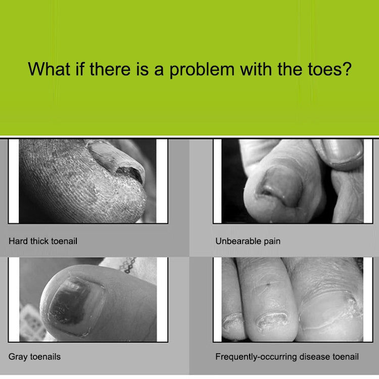 2 in 1 Nail Clipper for Paronychia Stainless Steel Olecranon Nail Nipper & Ingrown Nail Lifter