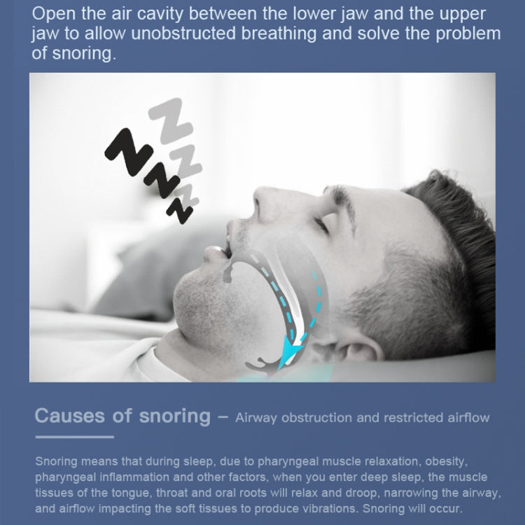 YJK100 Silicone + ABS Stop Snoring Device Anti Snore