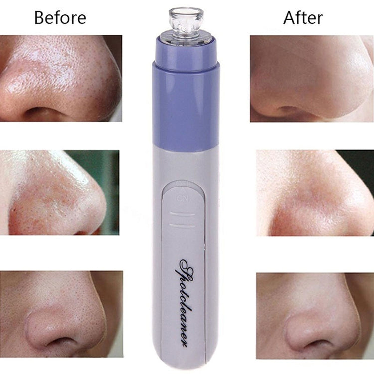 Facial Pore Cleanser Blackhead Vacuum Suction Remover