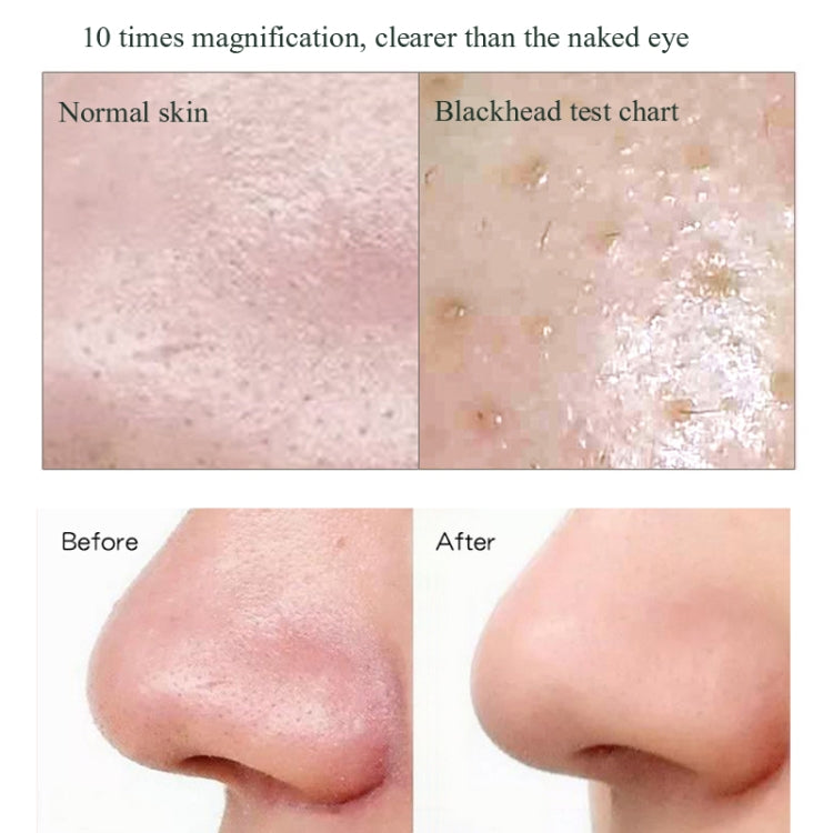 Blackhead Electric Pore Removal Machine Clean Facial Equipment,Style: