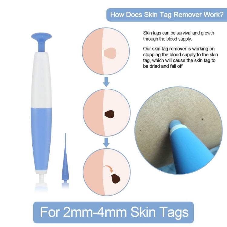 Skin Tag Removal Tool For 2mm-4mm Skin Tags