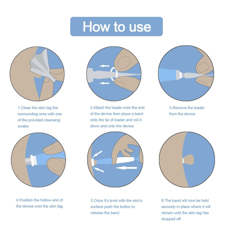 Skin Tag Removal Tool For 2mm-4mm Skin Tags