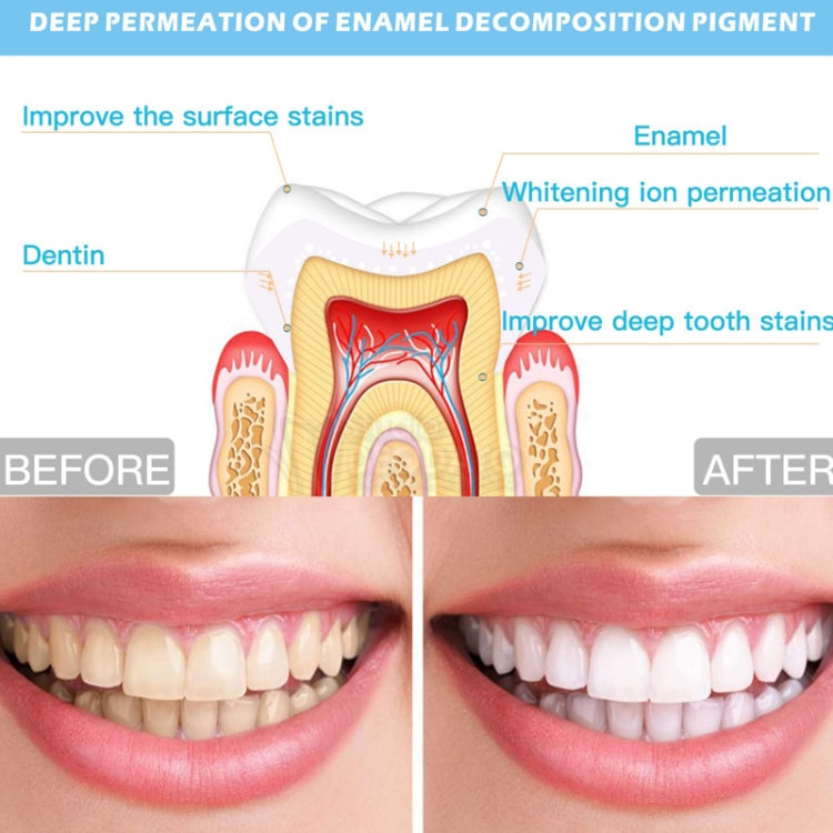 Wire-Controlled 25min Timing 16LED Teeth Whitening Device Dental Bleaching System