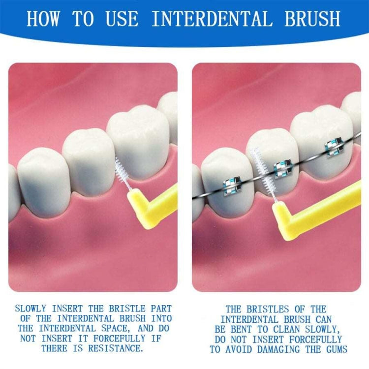 10pcs /Pack Orthodontic Teeth Interdental Brushes Dental Brace Wire Soft Bristles