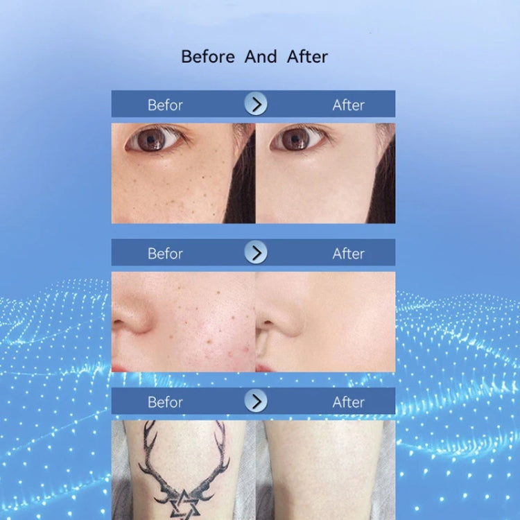 15 Gears Rechargeable Mole Spotting Pen Laser Beauty Instrument Spot Removal Magic Tool