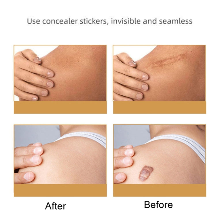 Silicone Skin Scar Invisible Self-Adhesive Cover Stickers Tattoo Acne Pits Breathable Waterproof Cuttable Concealer Stickers