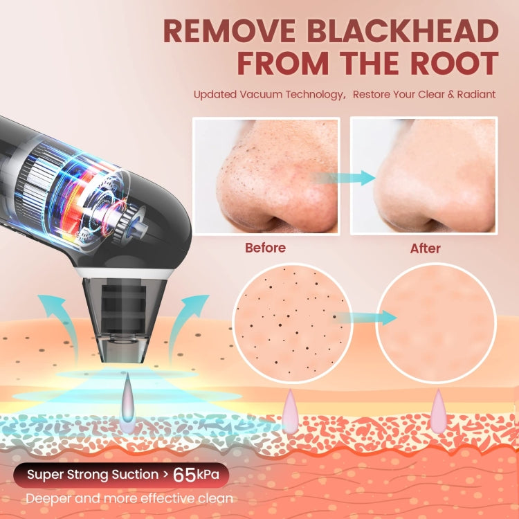 Electric Beauty Instrument Face Pore Remover Blackhead Acne Cleaner