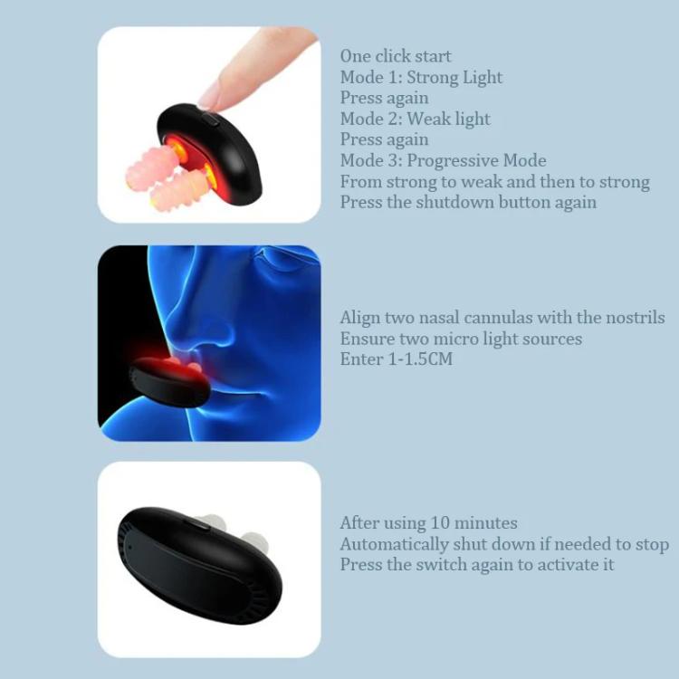 Intelligent Infrared Nasal Comfort Device Portable Allergic Chronic Rhinitis Instrument